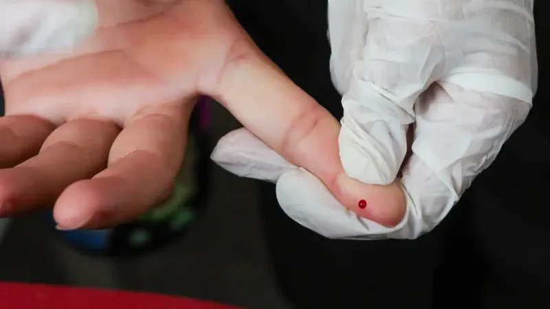 Maringá 98 FM — O Ministério da Saúde (MS) incorporou no Sistema Único de Saúde (SUS) o teste rápido para o diagnóstico da dengue. A inclusão do Teste Rápido de Dengue NS1 na tabela nacional de procedimentos do SUS está publicada no Diário Oficial da União desta quinta-feira (26). A oferta do exame é feita de forma ampla em ambulatórios de postos de saúde e em hospitais da rede pública de saúde. A solicitação do teste pode ser feita por médicos, enfermeiros, biomédicos e técnicos de enfermagem para pacientes de todas as idades. O método pode detectar a presença no sangue da proteína específica liberada pelo vírus [&hellip;]