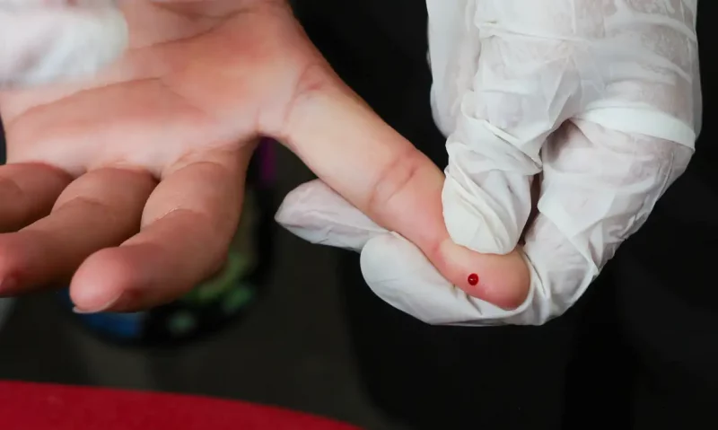 Maringá 98 FM — O Ministério da Saúde (MS) incorporou no Sistema Único de Saúde (SUS) o teste rápido para o diagnóstico da dengue. A inclusão do Teste Rápido de Dengue NS1 na tabela nacional de procedimentos do SUS está publicada no Diário Oficial da União desta quinta-feira (26). A oferta do exame é feita de forma ampla em ambulatórios de postos de saúde e em hospitais da rede pública de saúde. A solicitação do teste pode ser feita por médicos, enfermeiros, biomédicos e técnicos de enfermagem para pacientes de todas as idades. O método pode detectar a presença no sangue da proteína específica liberada pelo vírus […]