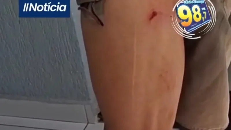 Maringá 98 FM — &nbsp; &nbsp; Um catador de latinhas foi atacado por três cachorros na manhã desta segunda-feira (13), na cidade de Pombal, no Sertão paraibano. O homem realizava seu trabalho por volta das 9h quando foi surpreendido pelos animais e acabou sendo mordido na perna. De acordo com o relato, esta é a segunda vez que o catador de recicláveis sofre ataque de cães no município, o que volta a acender o alerta para a circulação de animais soltos nas ruas e os riscos enfrentados por trabalhadores que atuam diariamente em vias públicas. Após o ocorrido, a vítima procurou a Rádio Maringá [&hellip;]