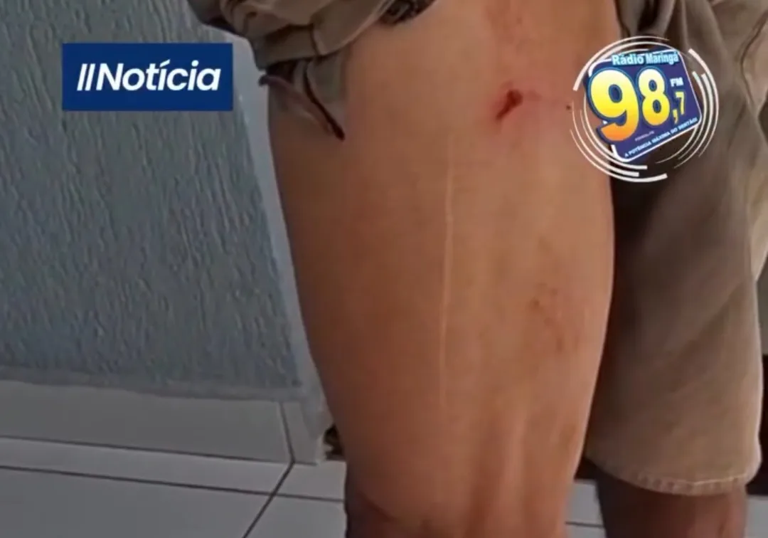 Maringá 98 FM —     Um catador de latinhas foi atacado por três cachorros na manhã desta segunda-feira (13), na cidade de Pombal, no Sertão paraibano. O homem realizava seu trabalho por volta das 9h quando foi surpreendido pelos animais e acabou sendo mordido na perna. De acordo com o relato, esta é a segunda vez que o catador de recicláveis sofre ataque de cães no município, o que volta a acender o alerta para a circulação de animais soltos nas ruas e os riscos enfrentados por trabalhadores que atuam diariamente em vias públicas. Após o ocorrido, a vítima procurou a Rádio Maringá […]