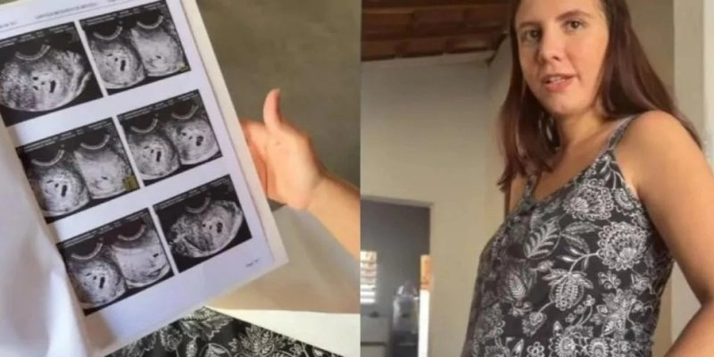 Maringá 98 FM — A jovem Laryssa Medeiros, de 22 anos, moradora de Patos, teve uma surpresa durante a realização de um exame ao descobrir que está grávida de cinco bebês.  Uma gestação de  quíntoplus é considerada extremamente rara. Estimativas médicas tradicionalmente citadas apontam que isso pode ocorrer em aproximadamente 1 caso a cada 55 milhões de gestações. Entretanto, essa frequência pode ser maior em situações que envolvem tratamentos de fertilidade, como indução da ovulação e fertilização assistida. A gestação de quíntuplos pode ocorrer de diferentes formas. Em alguns casos, cinco óvulos são fecundados por cinco espermatozoides diferentes, originando cinco irmãos geneticamente diferentes. Também pode [&hellip;]